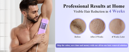 Xsoul Sapphire IPL — flash speed 1.2s vs competitor 2.5s comparison, 50% faster hair removal treatment