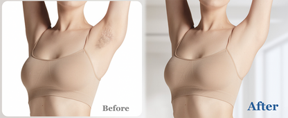 Xsoul IPL Rose Gold — before and after underarm hair removal comparison, permanent reduction results