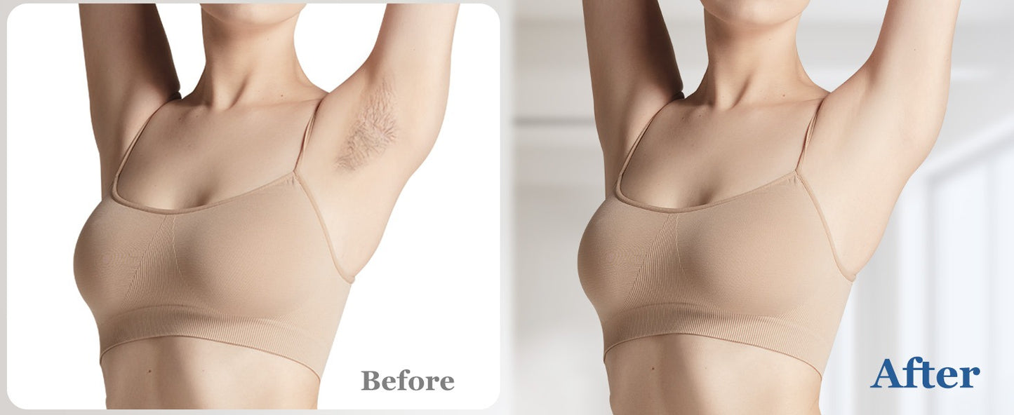 Xsoul IPL at-home hair removal White & Golden — before and after underarm results, permanent reduction