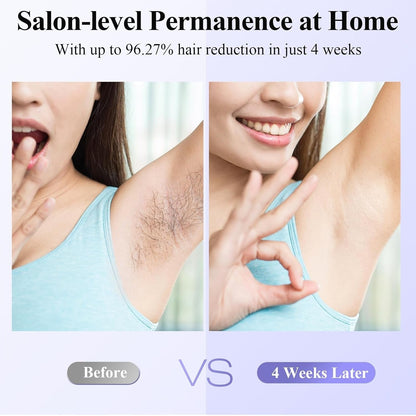 Xsoul Sapphire IPL — before and after 4-week hair removal results, 96% hair reduction verified by users